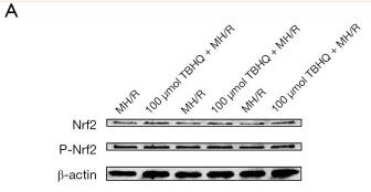 Phospho-Nrf2 (Ser40) Antibody - Figure 2
Phosphorylated Nrf2 reduced apoptosis.