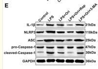 NLRP3 Antibody - Figure 3
Effects of Ori, autophagy agonist Rap and autophagy inhibitor 3-MA on NLRP3 inflammasome in LPS-induced depression mouse models.