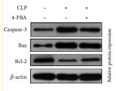 Bcl-2 Antibody - Figure 3
Expression levels of mTOR pathway proteins, ERS-associated proteins, and apoptosis-associated proteins in WT, CLP, and CLP+4-PBA mouse groups.