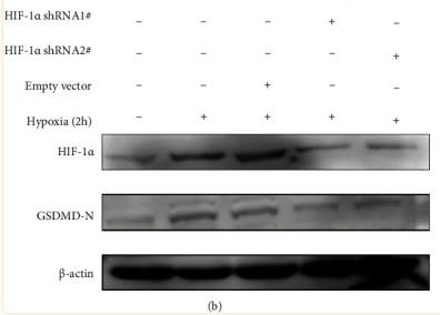 HIF1A Antibody - Figure 1
Hypoxia-mediated induction of pyroptosis in fibroblast-like synoviocytes (FLS).