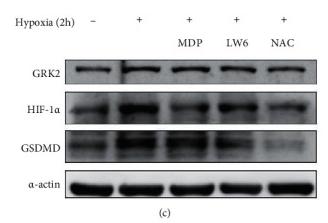GSDMD Antibody - Figure 7
Excessive reactive oxygen species (ROS) upregulates the expression level of G protein-coupled receptor kinase 2 (GRK2) under hypoxia in fibroblast-like synoviocytes (FLS).