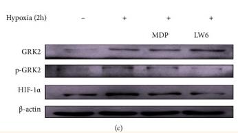 beta Actin Antibody - Figure 6
Monomeric derivative of paeoniflorin (MDP) inhibits the expression of hypoxia-inducible factor (HIF)-1α through targeted inhibition of GRK2 S670 phosphorylation.