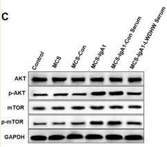 mTOR Antibody - FIGURE 2
The effects of the supernatant of mesangial cells treated with Liuwei Dihuang pills and aIgA1 on the autophagy level and PI3K-Akt-mTOR pathway of podocytes were detected.