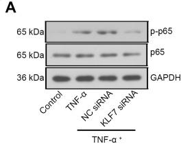 NF-kB p65 Antibody - Fig.