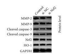 Cleaved-Caspase 9 (Asp353) Antibody - Figure 3
Proliferation, migration, and apoptosis of lung cancer cells after Nrf2 siRNA transfection.