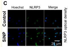 NLRP3 Antibody - Figure 2
SiNP induces pyroptosis in RAW-ASC cells.