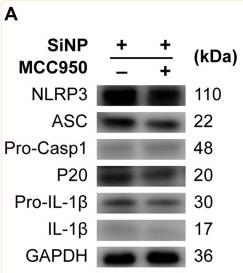 NLRP3 Antibody - Figure 3
SiNP exposure induces NLRP3-dependent pyroptosis in RAW-ASC cells.