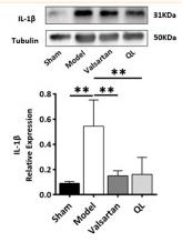 IL1 beta Antibody - FIGURE 5
QL suppresses IL-1β, NF-κB, and TNF-α expression.