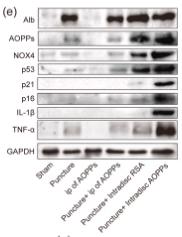 IL1 beta Antibody - Figure 1
AOPPs accumulate in IVDD, up-regulate the expression of NOX4, senescence markers, and their associated inflammatory proteins, and accelerate IVDD.