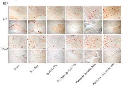 NOX4 Antibody - Figure 1
AOPPs accumulate in IVDD, up-regulate the expression of NOX4, senescence markers, and their associated inflammatory proteins, and accelerate IVDD.
