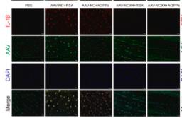 IL1 beta Antibody - Figure 7
Blocking NOX4 expression in vivo by AAV delays IVDD.