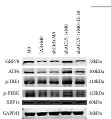 Phospho-IRE1 (Ser724) Antibody - Figure 7
Endoplasmic reticulum stress is involved in IL-10-mediated macrophage polarization.