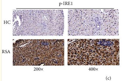 Phospho-IRE1 (Ser724) Antibody - Figure 8
(a–e) The protein levels of endoplasmic reticulum stress-related proteins in decidua of patients with the RSA and the HC groups, as measured using immunohistochemistry (n = 5).