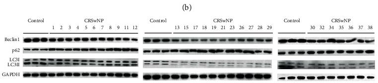 LC3A/B Antibody - Figure 3
Autophagy levels in different CRSwNP subtypes.