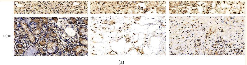 LC3A/B Antibody - Figure 3
Autophagy levels in different CRSwNP subtypes.