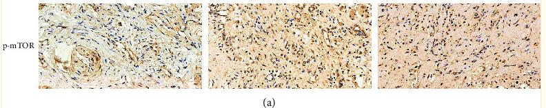 Phospho-mTOR (Ser2448) Antibody - Figure 2
Activation of the Akt/mTOR pathway in different CRSwNP subtypes.