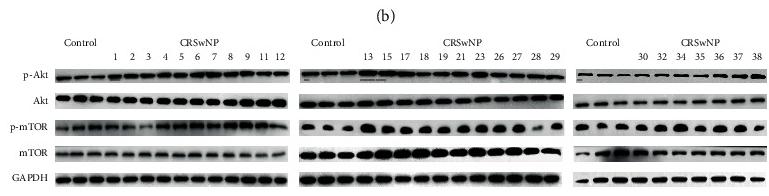 Phospho-mTOR (Ser2448) Antibody - Figure 2
Activation of the Akt/mTOR pathway in different CRSwNP subtypes.