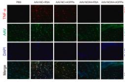 TNF alpha Antibody - Figure 7
Blocking NOX4 expression in vivo by AAV delays IVDD.