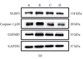 Cleaved-Caspase 1 (Asp296), p20 Antibody - Figure 12
LGZGD regulates protein expressions of NLRP3, Caspase-1, and GSDMD in AMI rats: (a) NLRP3, Caspase-1, and GSDMD pictures of Western spots; (b) NLRP3; (c) Caspase-1 p20; (d) GSDMD.