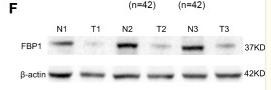beta Actin Antibody - Figure 1
FBP1 is reduced in RCC and related to poor survival outcome.