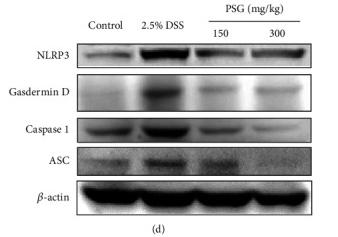 GSDMD Antibody - Figure 6
PSG suppressed pyroptosis of the liver tissues in IBD mice.