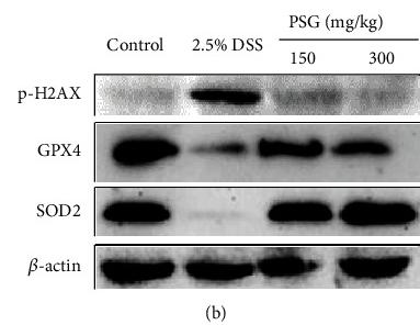 SOD2/MnSOD Antibody - Figure 8
PSG alleviated oxidative damage of the liver tissues in IBD mice.
