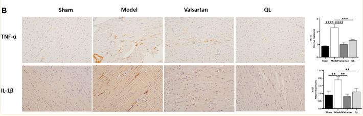 IL1 beta Antibody - FIGURE 5
QL suppresses IL-1β, NF-κB, and TNF-α expression.