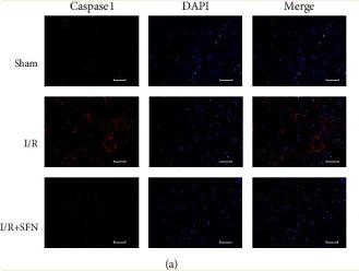 Caspase 1 Antibody - Figure 3
(a) Immunofluorescent staining labeled pyroptosis marker caspase-1 was conducted to assess the extent of pyroptosis in each group of mice (scale bar = 50 μm); (b) Western blot was used to examine the expression of pyroptosis markers in the muscle homogenate of each group of mice.