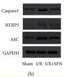 Caspase 1 Antibody - Figure 3
(a) Immunofluorescent staining labeled pyroptosis marker caspase-1 was conducted to assess the extent of pyroptosis in each group of mice (scale bar = 50 μm); (b) Western blot was used to examine the expression of pyroptosis markers in the muscle homogenate of each group of mice.