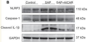 Cleaved-IL-1 beta (Asp116) Antibody - FIGURE 4
The effects of AICAR on the activation of the AMPK/Nrf2 signaling pathway and inhibition of NLRP3 inflammasome activation in the liver tissues of sodium taurocholate-induced SAP rats.