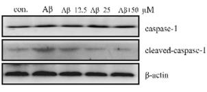 Cleaved-IL-1 beta (Asp116) Antibody - Fig.