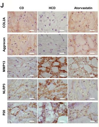 Cleaved-Caspase 1 (Asp296), p20 Antibody - FIGURE 4
Hypercholesterolemia induces IDD and pyroptosis-associated molecular changes, which were attenuated by atorvastatin.