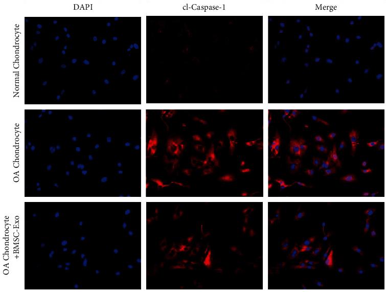 Cleaved-Caspase 1 (Asp296), p20 Antibody - Figure 2
BMSC-Exos inhibit the pyroptosis and maintain chondrocyte homeostasis of OA chondrocytes.