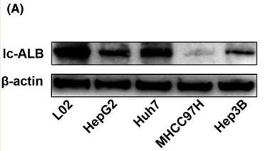 beta Actin Antibody - FIGURE 2
A, B, The expression of ALB was lower in hepatocellular carcinoma (HCC) cell lines compared with the normal L02 cells assessed by western blot.