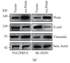 beta Actin Antibody - Figure 2
Pinin induces EMT and malignant progression in HCC.