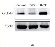 beta Actin Antibody - Figure 1
Therapeutic effect of HQT on barrier function injury of DSS-induced ulcerative colitis (UC) mice.