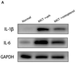IL6 Antibody - Figure 5
Notopterol attenuates the pro-inflammatory factors in the lungs of PAH rats.