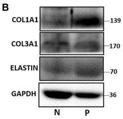 Collagen I Antibody - Figure 2
Quantification analyses of type I collagen, type III collagen and elastin in vagina tissue of pelvic organ prolapsed patients.