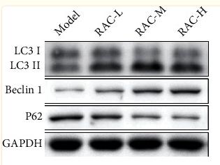 LC3A/B Antibody - Figure 7
RAC induced the autophagy of the tumor cell in RCC mice.