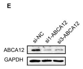 GAPDH Antibody - FIGURE 3
mRNA and protein expression of ABCA12 in pancreatic cancer.