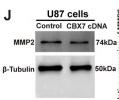 MMP2 Antibody - Figure 6
The potential function prediction and validation of CBX family in proliferation and invasion of glioma cells.