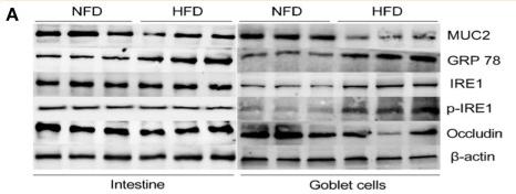Phospho-IRE1 (Ser724) Antibody - Figure 4
High-fat diets increase intestinal permeability via disturbing the secretion of MUC2 in goblet cell.