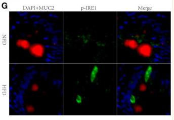 Phospho-IRE1 (Ser724) Antibody - Figure 4
High-fat diets increase intestinal permeability via disturbing the secretion of MUC2 in goblet cell.