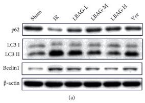 LC3A/B Antibody - Figure 5
Effect of LBAG on the expression of autophagy and PI3K/AKT pathway-related proteins in rats.