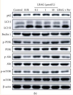 PI3K p85 alpha Antibody - Figure 8
Effect of LBAG on the expression of autophagy and PI3K/AKT pathway-related proteins in H9c2 cells with H/R injury.