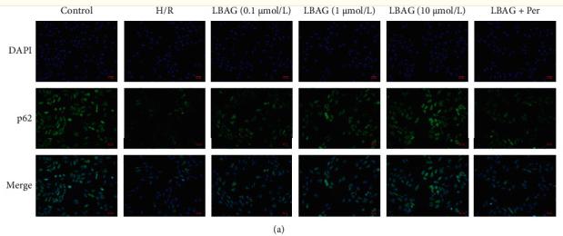 SQSTM1/p62 Antibody - Figure 8
Effect of LBAG on the expression of autophagy and PI3K/AKT pathway-related proteins in H9c2 cells with H/R injury.