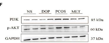 GAPDH Antibody - Figure 5
Effects of DOP treatment on the PI3K–Akt–mTOR signaling pathway in rats by qPCR and Western blot.