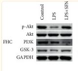 GAPDH Antibody - Figure 8
Expression of PI3K/Akt/GSK-3β pathway-related proteins in FHC (a) and IEC-6 (b) cells.