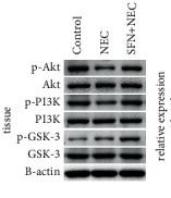 PI3K p85 alpha Antibody - Figure 5
Expression levels of PI3K/Akt/GSK-3β pathway-related proteins in intestinal tissue of NEC mice.