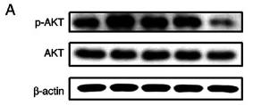 Phospho-AKT1/2/3 (Ser473) Antibody - Figure 5
Effect of inonotsuoxide B on PDGF-BB-induced AKT, ERK1/2 and PI3K phosphorylation in hepatic stellate cells.